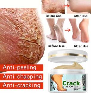 GABBU heel repair cream Smooth Foot Crack Cracked Heel Repair Foot Cream