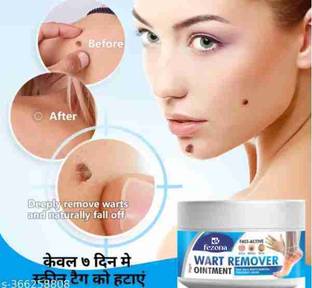 FEZONA Mole Wart Remover Cream, Massa Removal Cream