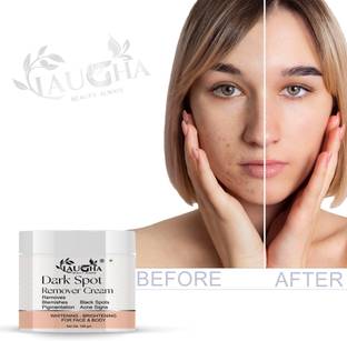 Laugha Dark Spot Remover Cream, Pimple Marks, Acne Scar, Pigmentation