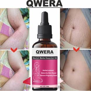 Qwera Stretch Marks Oil to Reduce Stretch Marks & Scars