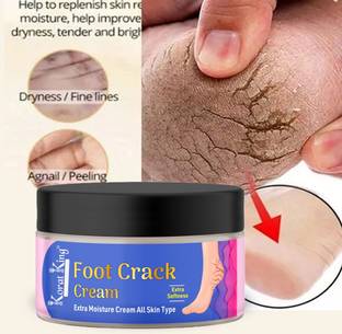 KORAT KING Foot Cream For Rough, Dry and Cracked Heel, Feet Cream For Heel Repair