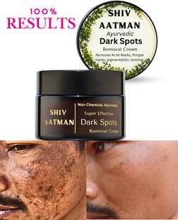 Shiv Aatman Melasma Removal Pigmentation Removal, Dark Spots Removal Cream ( Non Chemical )