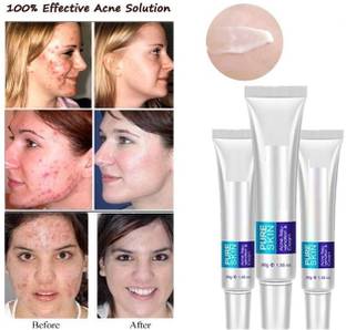 MYEONG Face care Anti Acne Treatment Cream