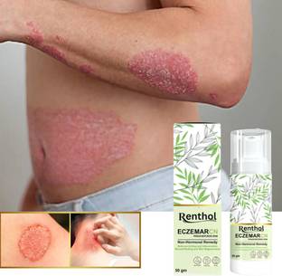 Renthol Eczemaron Anti Fungal Cream For Men & Women ItchCoat-Eczema cream Spary
