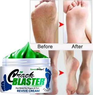 smartdrops Foot Cream for Soft, Healthy Feet,Cracked Heel Repair, Pure Comfort