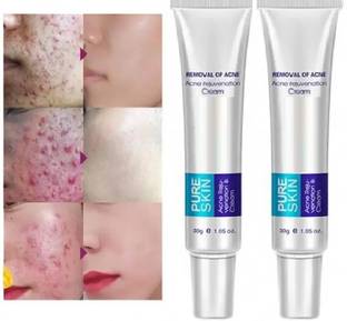 YAWI best result cream, Pimple Marks, Acne Scar, Pigmentation