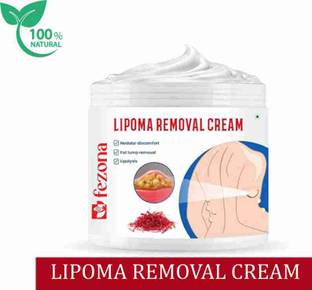 FEZONA Lipoma Removal Cream | Lipolysis | Fat Lump Remover 100 gm