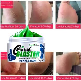 smartdrops Foot Crack Cream For Dry Cracked Heels & Feet