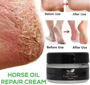 JOYHERBS Foot Crack Cream For Dry Cracked Heels & Feet 100% Guaranteed Man And Woman