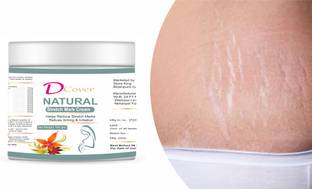 D cover NATURAL STRECH MARK REMOVAL CREAM FOR
