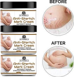 Jai Ambala Anti Stretch Marks Cream to Reduce Stretch Marks & Scars-50gm-3-Jar-