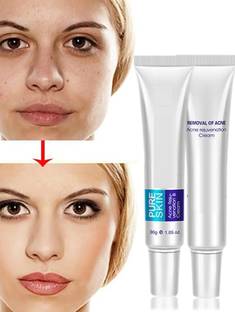 MYEONG Anti Acne Scar Mark Remover Cream Combo