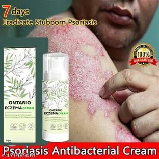 Ontario ECZEMA CREAM MEN & WOMEN (PACK OF 1)
