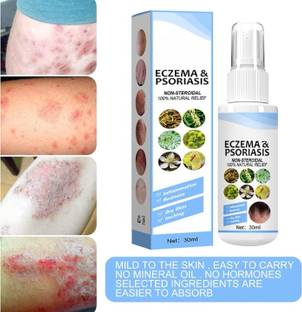 youmore Psoriasis Relief Spray Skin Treatment, Soothing for Dry Dehydrated Skin PO2