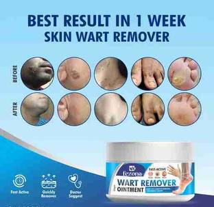 FEZONA Skin Wart Remover Ointment Cream - 100 gm