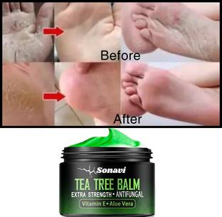 Sonavi Foot Repair Cream, Foot Fungus, Dry Cracked Feet and Smelly Feet