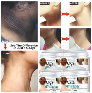 Sandarbh Neck Back Whitening Cream | Removes Fine Lines & Tanning, Lightens, Nourishes, -