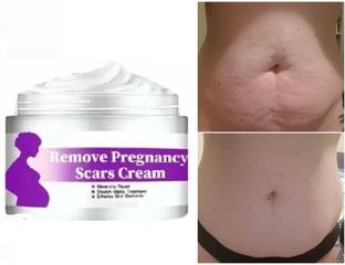 FLORERO Stretch Mark Repair and Removal Cream