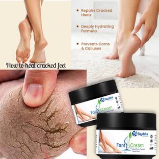 SIYDDIA Foot Cream with Vitamin E, Peppermint & Argan Oil 4 creacked heel repair cream