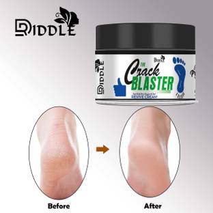 DRIDDLE Crack Blaster Soft Foot Cream Cracked heel repair foot cream Pack of 1 {50gm}