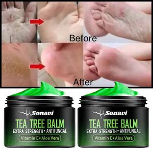 Sonavi Foot Repair Cream, Foot Fungus, Dry Cracked Feet and Smelly Feet