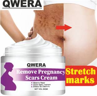 Qwera Stretch Marks Cream to Reduce Stretch Marks & Scars