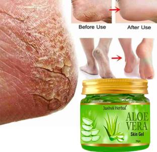 jashvii herbal feet crack heel repair cream Smooth Foot Crack Cracked Heel Repair Foot Cream