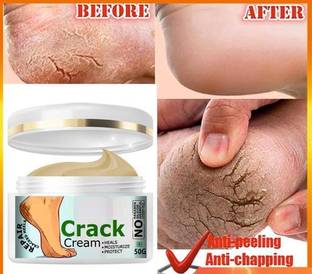 GABBU feet crack heel repair cream Smooth Foot Crack Cracked Heel Repair Foot Cream
