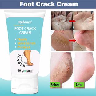 REFOAM feet Smooth Foot Crack Cracked Heel Repair Foot Cream