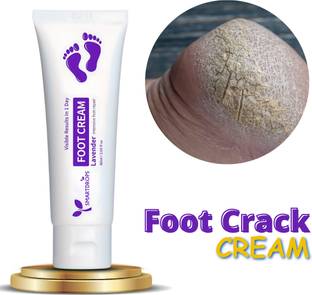 smartdrops Foot & Hand Crack Heal Cream for Women & Men