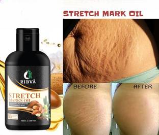 RIBVA Stretch Marks Removal Oil Pack Of 1