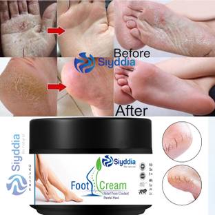 SIYDDIA New Foot Crack Cream For Dry,cracked feet&hand-50g