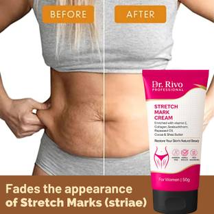 Dr rivo professional Stretch Mark Removal Cream for Women | Fades Scars & Marks |