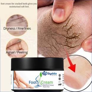 SIYDDIA feet crack heel repair cream Smooth Foot Crack Cracked Heel Repair Foot Cream