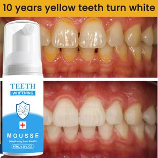 REGLET FROSTY FUSION MINT FLAVOURED FOAM FOR BRIGHTER TEETH,MINTY FOAM,FAST RESULT - MINT