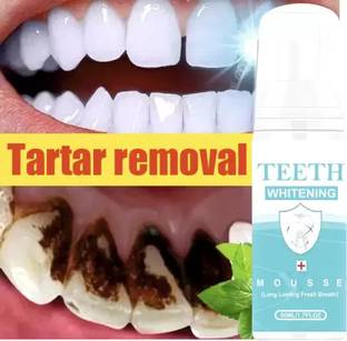 fabulik Teeth Whitening Foam to Ultra-fine Deeply Clean Gums Intensive Stain Removal Teeth Whitening liquid