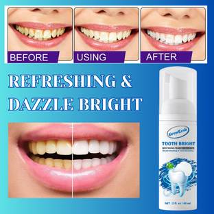 Growkesh Effervescent Smile, Teeth Whitening Foam for Radiant Results - Mint