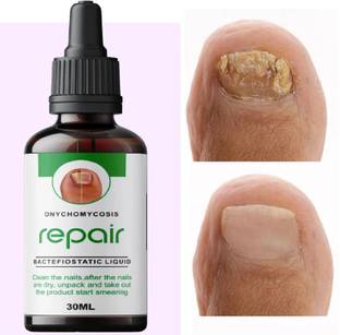 Edith Nail growth oil fast, nail strong oil, nail strong serum