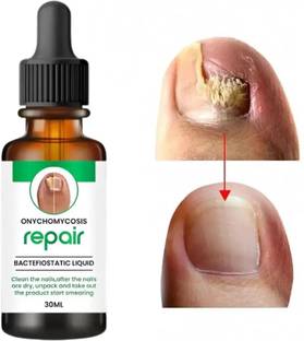 Payalx Anti-Fungal Nail Serum for Nail Growth & Repair. Professional Formula