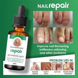 Estetica "Fungal Nail Treatment Liquid | Repair & Removal Solution for Nails (30 ml)" N/A