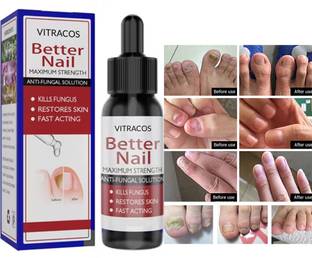VITRACOS Advanced Nail Repair Serum – Strengthens, Nourishes & Grows Nails Fast Blue