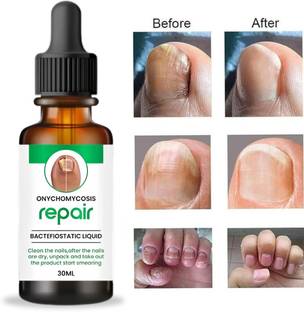 PANARO Nail Serum - Boost Nail Growth, Strong and Repair Nails | Cutical Care clear