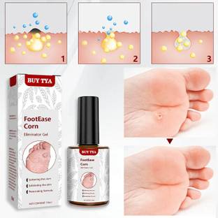 Buy TYA Footease Corn Eliminator Gel - Fast Relief for Corns & Calluses