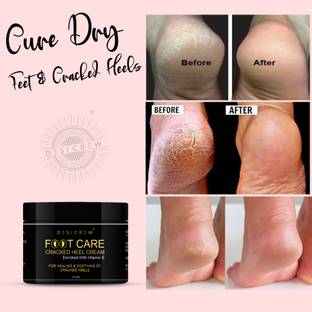 Desi Crew Feet Crack Heel Repair Cream Smooth Foot Crack Cracked Heel Repair Foot Cream