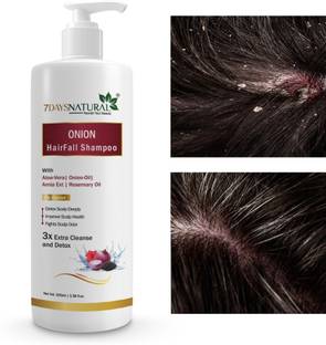 7 Days Premium Faster Onion Black seed Hair Fall Shampoo for Hair Growth & Hair Fall Control, with Onion Oil & Plant Keratin Men & Women