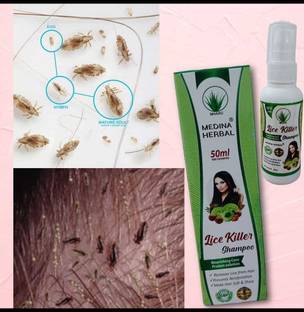 MEDINA HERBAL Lice Killer Shampoo