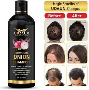 Udaun Premium Onion Shampoo