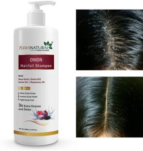 7days natural Onion Shampoo For Hair Growth anti hair fall dandruff control hair loss problem