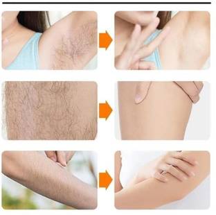 Emijun Painless Body Hair Removal Spray for legs, hands, underarm & back