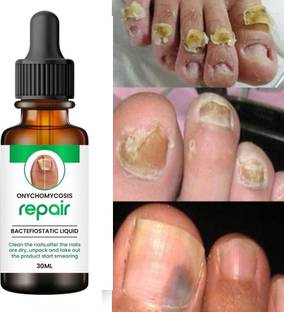KORAT KING Nail Serum & Repair Nails-